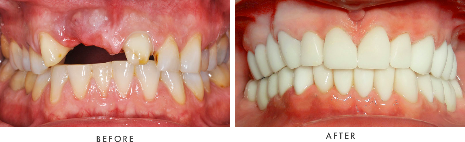 Before And After Photos Minnillo And Marshall Dental Elyria Grafton Oh